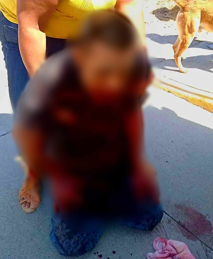 JACONA Grave hombre baleado en Lomas del Pedregal (2)