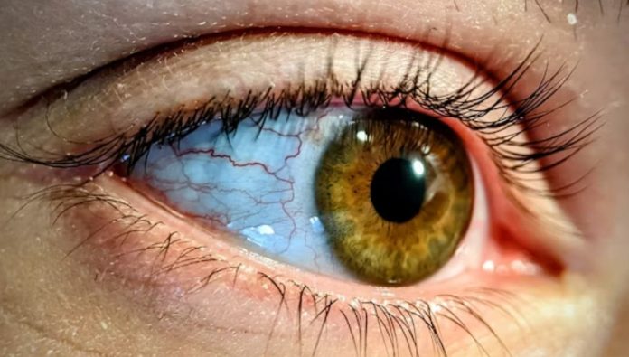 ojo3-compressed