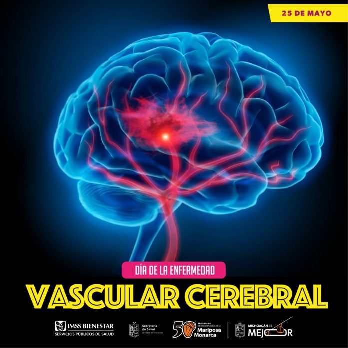 vascular